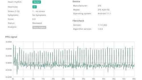 Nach der Messung erstellt die FibriCheck-App einen Report. (c) FibriCheck